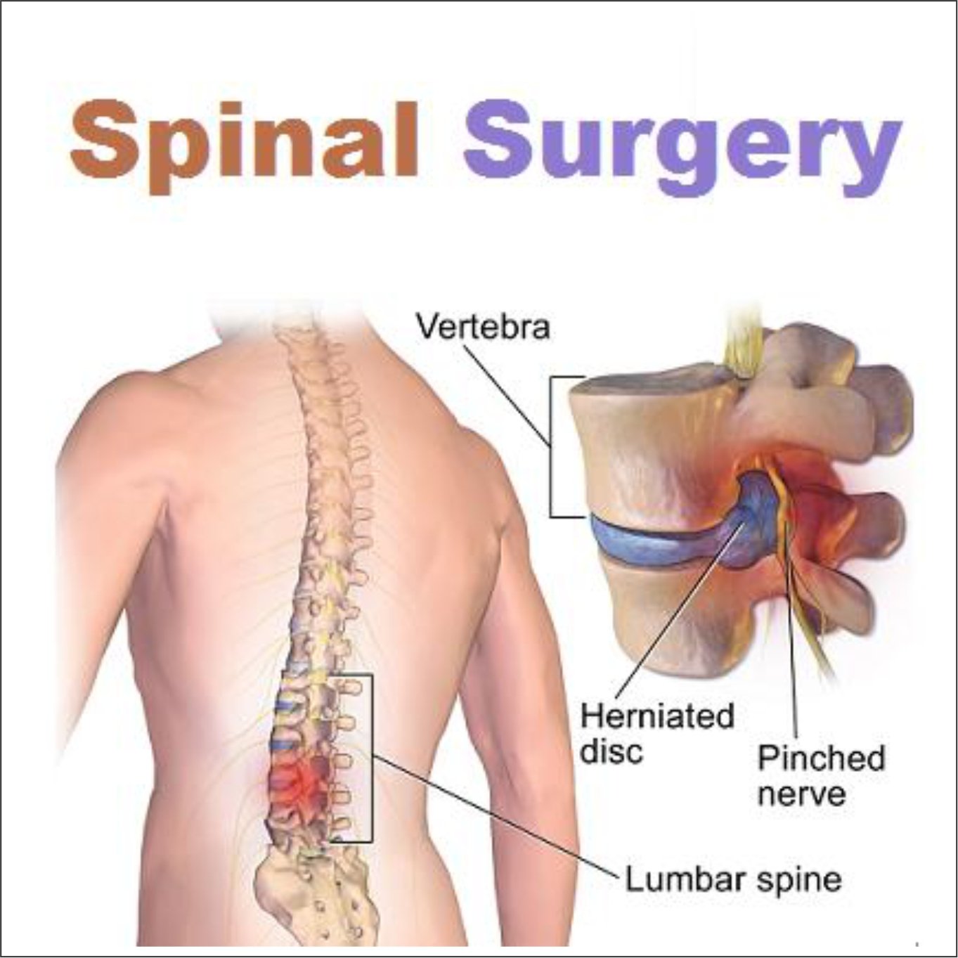 Spine Care